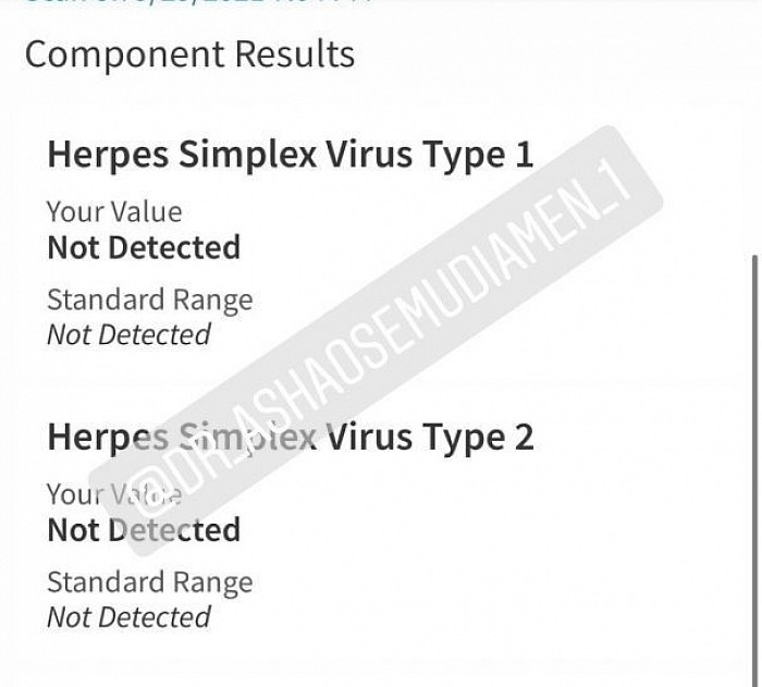 Herpes simplex virus type 1 & 2 negative results